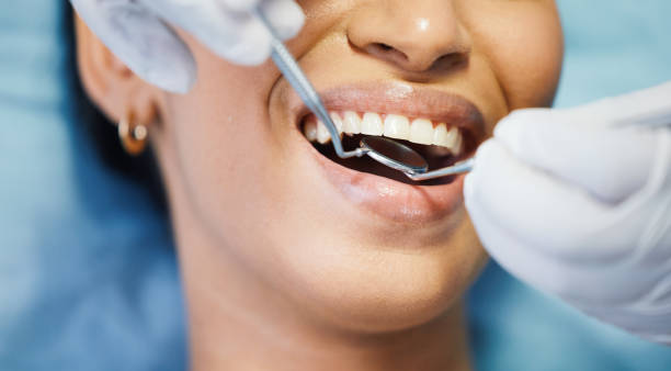Best Emergency Root Canal Treatment in Midwest City, OK
